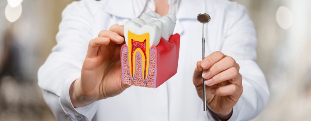 Root Canal Treatment in Gisborne
