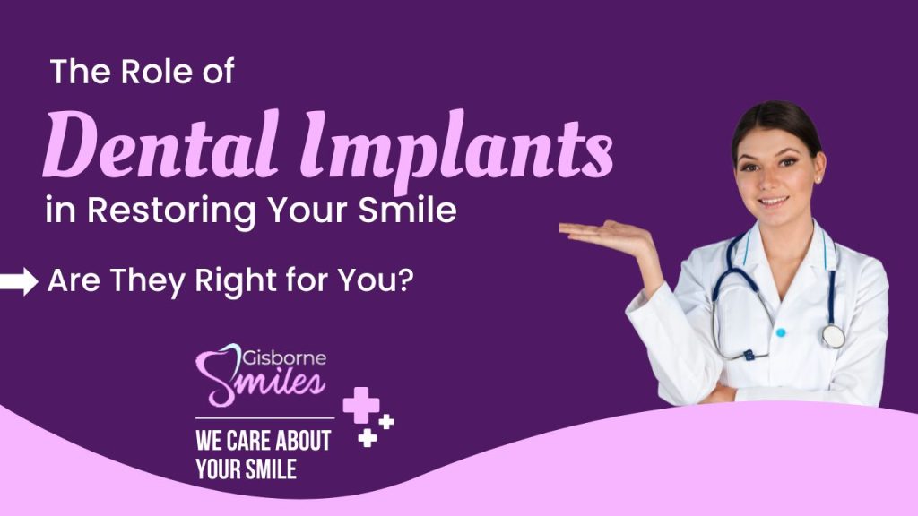 Role of Dental Implants in Restoring Your Smile